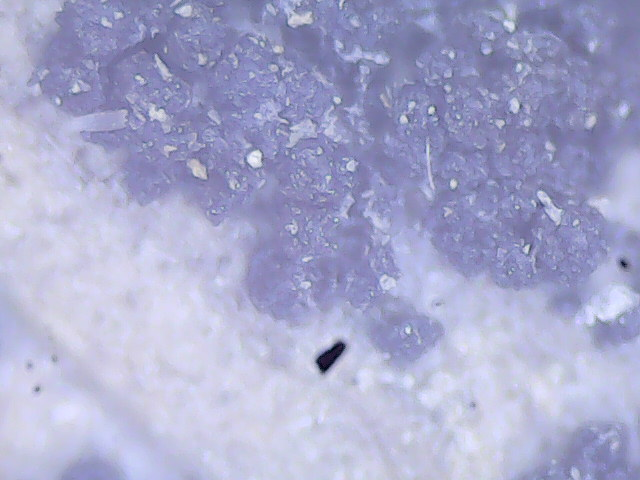 Fusariose de l’épi (Fusarium graminearum)