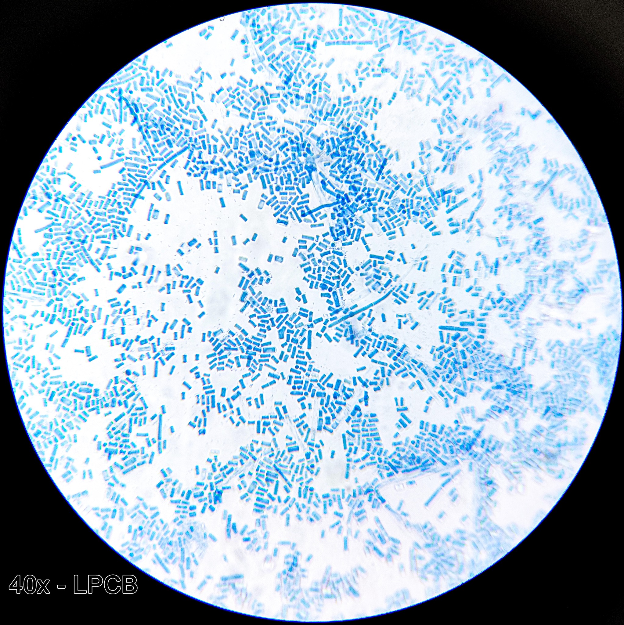 Geotrichum des fromages (Geotrichum candidum)